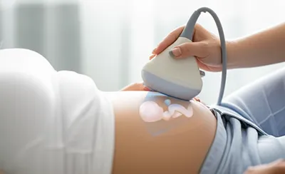 Illustration ultrasound - Image 1