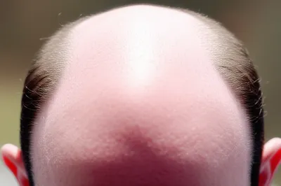 Illustration polls - Image 1