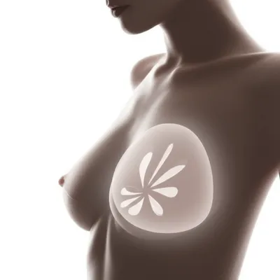 Hình ảnh minh họa implants