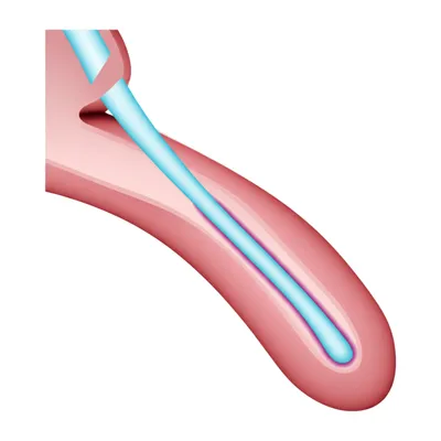 Illustration pokes - Image 1