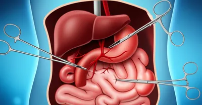 Illustration surgery - Image 1