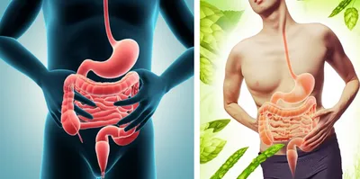 Illustration aperient