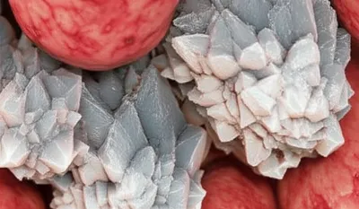 Illustration stones - Image 1