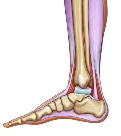 Illustration plafonds - Image 1