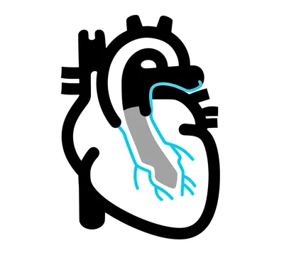 Illustration shunted - Image 1