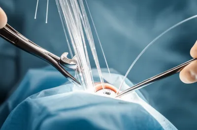 Illustration chandelier - Image 1