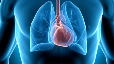 Illustration effusion - Image 1