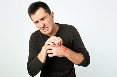 Illustration itches - Image 1