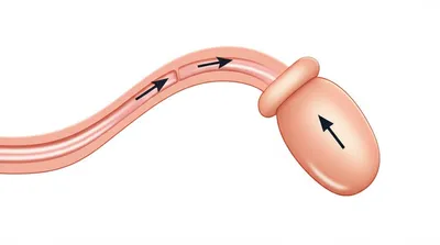 Illustration poke - Image 1