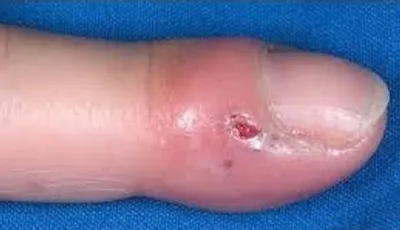 Illustration felon - Image 2