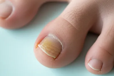 Illustration corns - Image 1