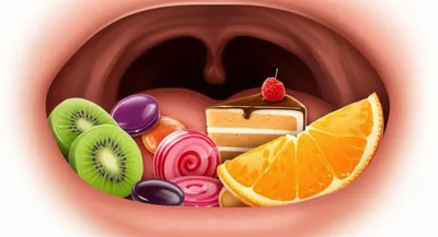 Illustration palatal - Image 1