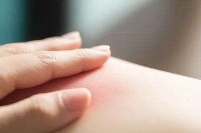 Illustration spank - Image 1