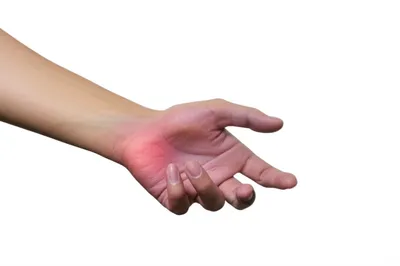 Illustration stroke - Image 1