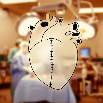 Illustration surgeries