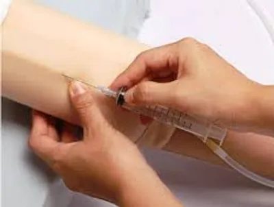 Illustration intravenous - Image 2