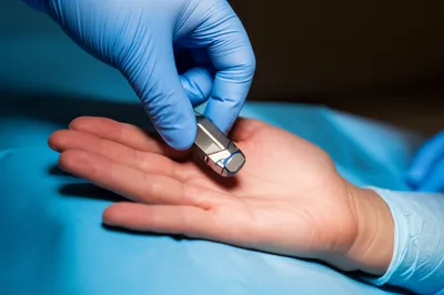 Illustration implanted - Image 1