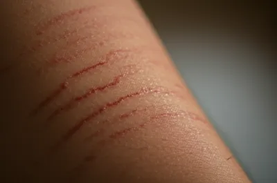 Illustration wale - Image 1