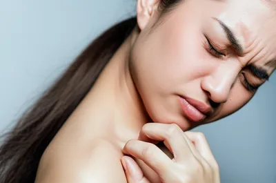 Illustration itches - Image 1