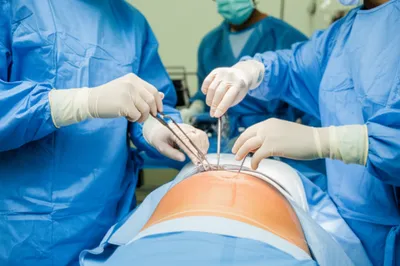 Illustration sectioned - Image 1