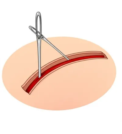 Illustration acupressure - Image 1