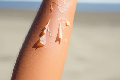 Illustration peeling - Image 1