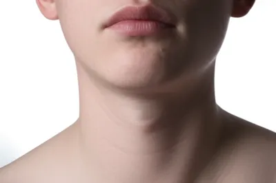 Illustration croak - Image 1