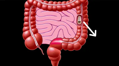 Illustration backdoors - Image 1