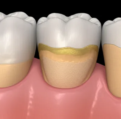 Illustration cements - Image 1