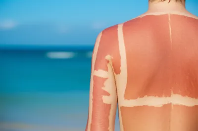 Illustration burnt - Image 1