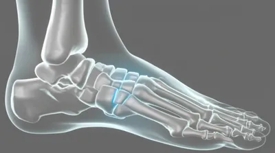 Illustration cuneiform - Image 1