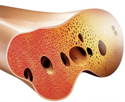 Illustration medullary