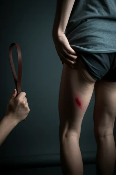 Illustration strapping - Image 1