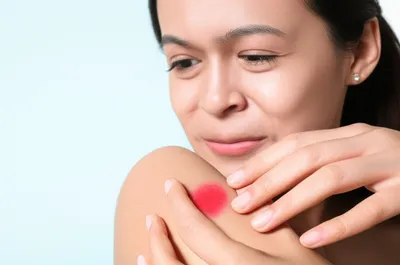 Illustration stinging - Image 1