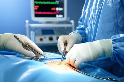 Illustration operates - Image 1