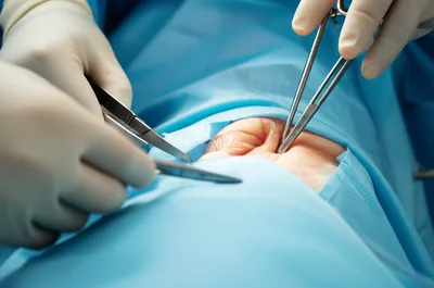 Illustration surgery - Image 1