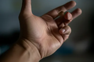 Illustration snap - Image 1