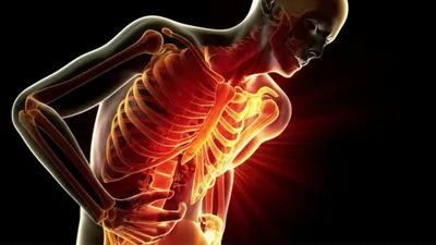 Illustration spasm - Image 1