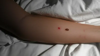 Illustration bedbugs