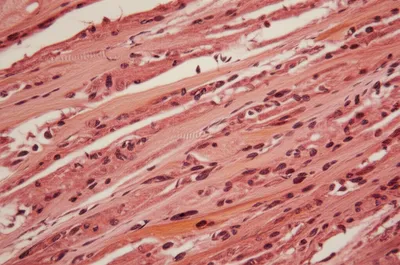 Illustration tubules