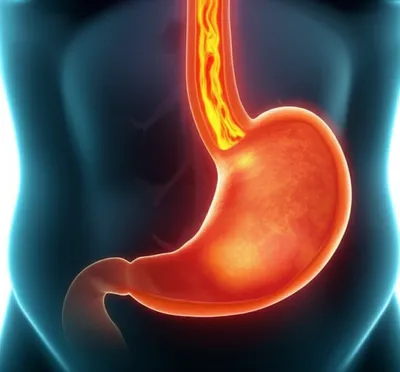 Illustration heartburn