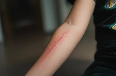 Illustration wailing - Image 1