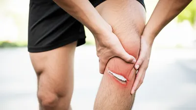 Illustration hamstrings - Image 1