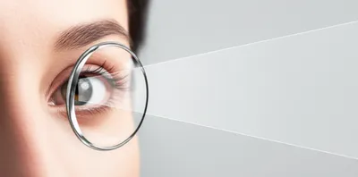 Illustration dioptre - Image 1