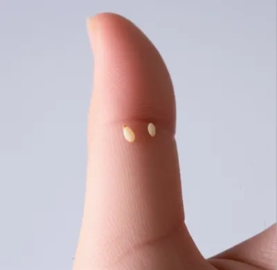 Illustration sesamoid - Image 1