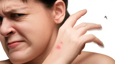 Illustration irritates