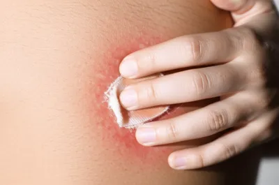 Illustration scratch - Image 1