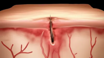 Illustration tails - Image 1