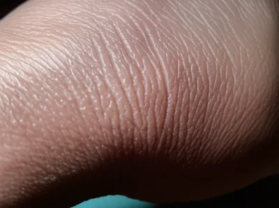 Illustration wrinkling - Image 1